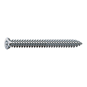 Frame Anchors